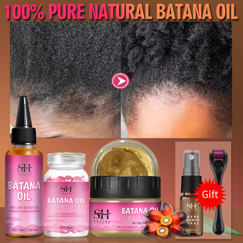 Best of Batana Hair Growth Oil For Men 100% Pure Batana Oil Hair Care Capsules Hair Regrowth Baldness Oil Hair Loss Treatment For Women Reviews & Tips