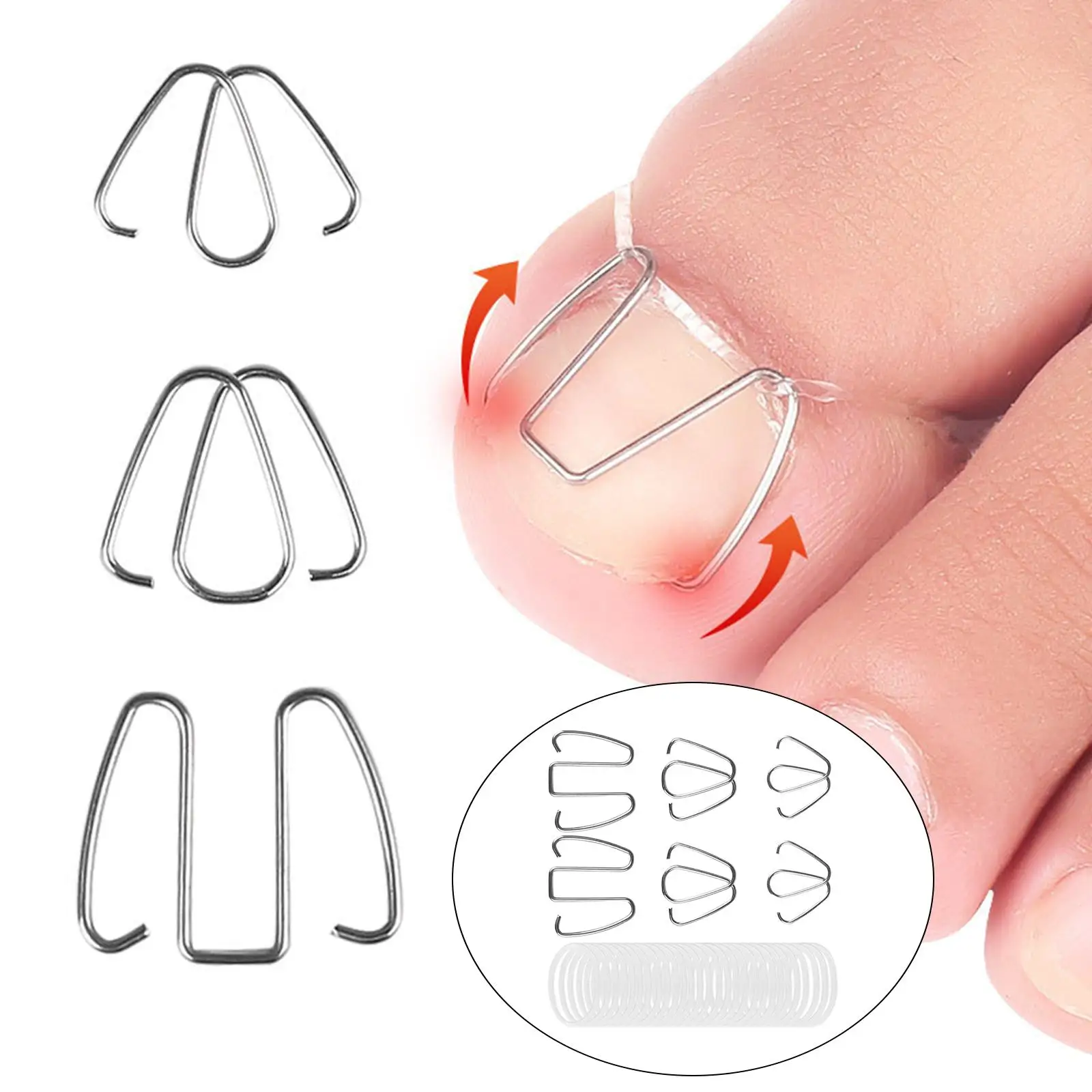 6 Pieces Ingrown Toenail Corrector Wire with Rubber Rings Foot Care Tool Ingrown Toenail Lifter Recovery Tool Bunion Corrector