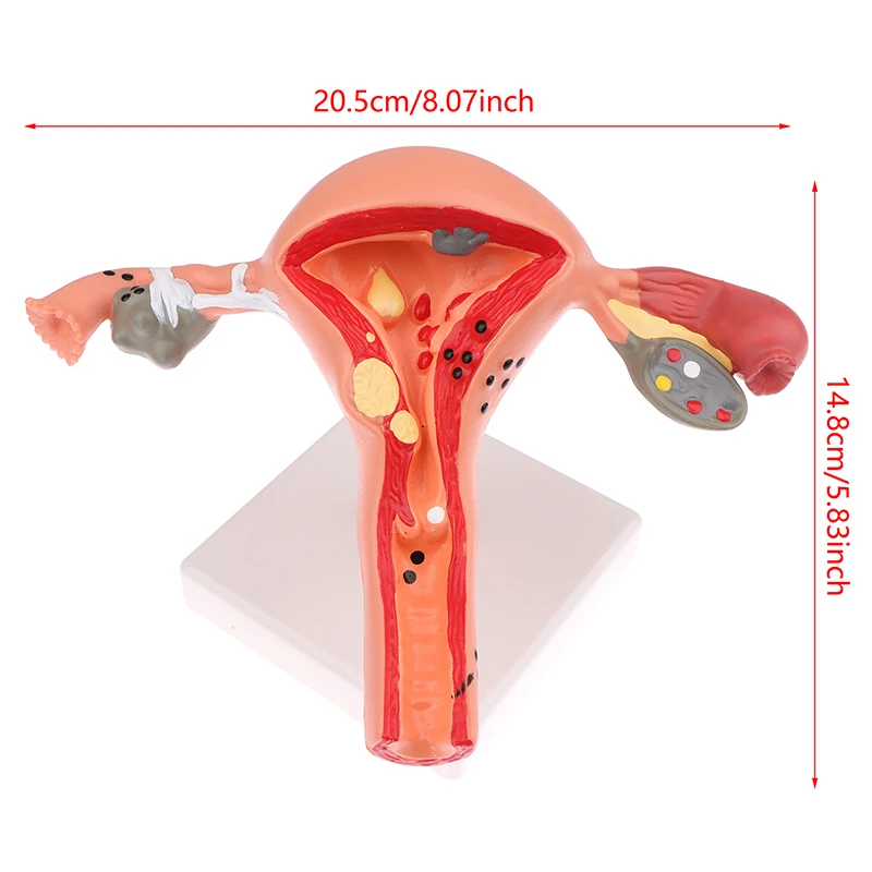 Modelo anatômico do ovário do útero, modelo