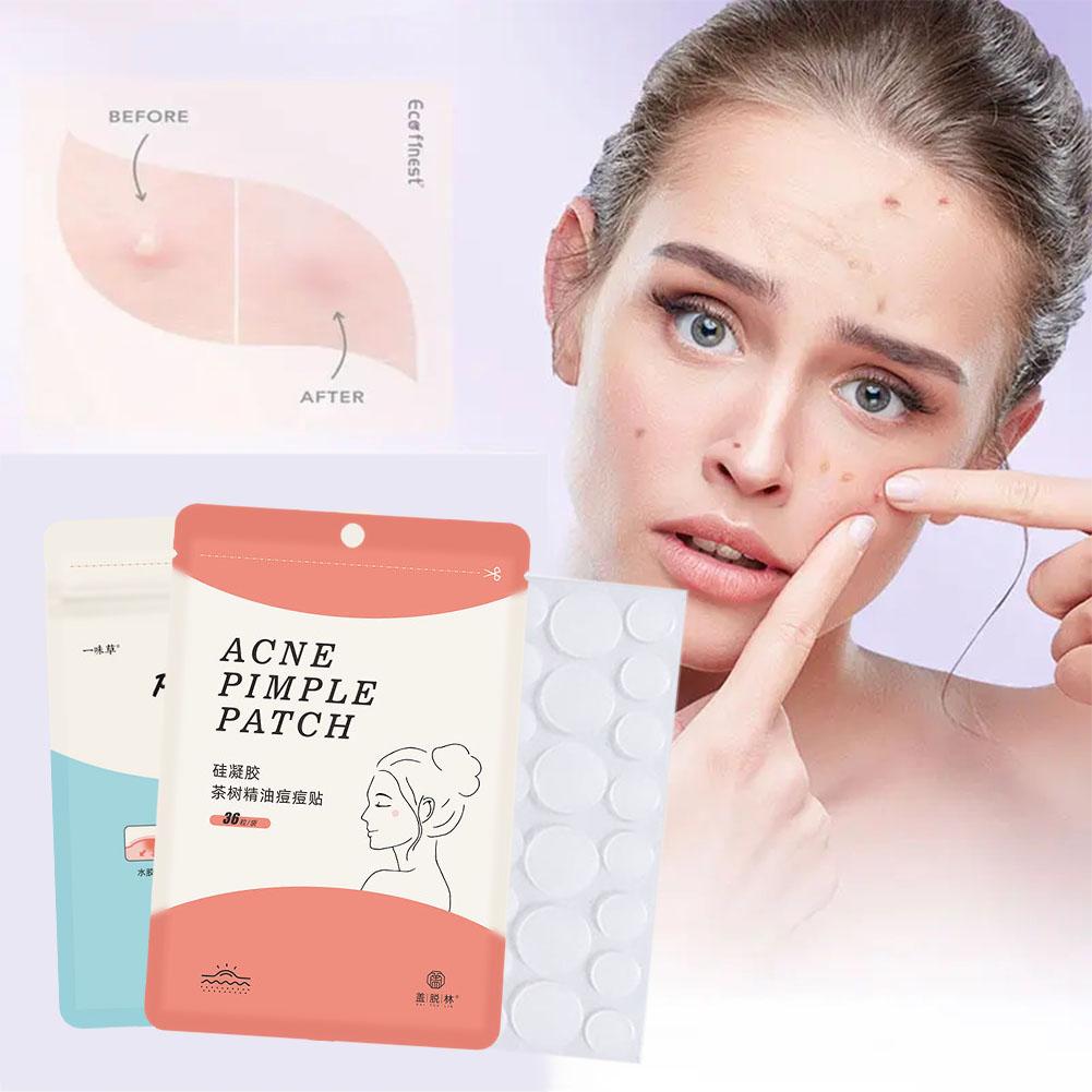 Best of Acne Pimple Patch Stickers Pimple Remover Patches Absorb Invisible Care Treatment Skin Beauty Facial Acne Tool Pus V8H7 Reviews & Tips