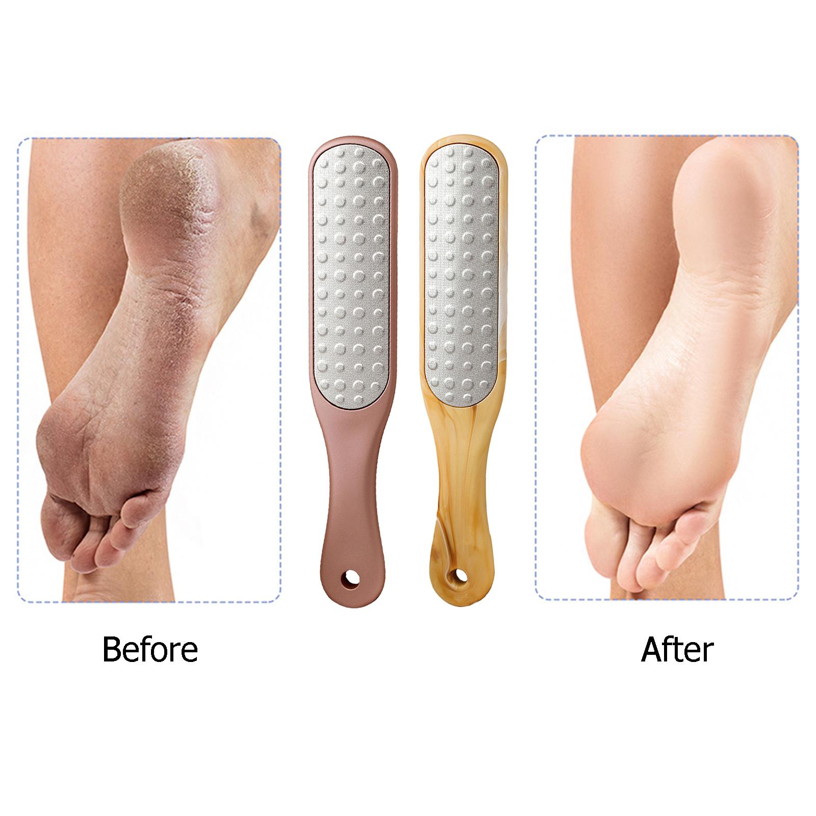 Foot Scrubber Double Side Pedicure Tools Portable Manual Foot Plate Foot Grinder for Dead Dry Skin Hard Skin Exfoliate Calluses