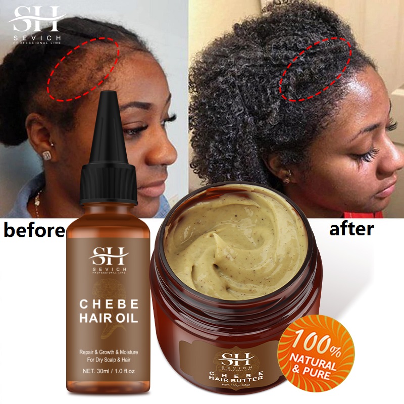 Best of Sevich Chebe Fast Hair Growth Set Anti Hair Loss Treatment Spray Craze Anti Break Hair Care New Africa Baldness Treatment Care Reviews & Tips