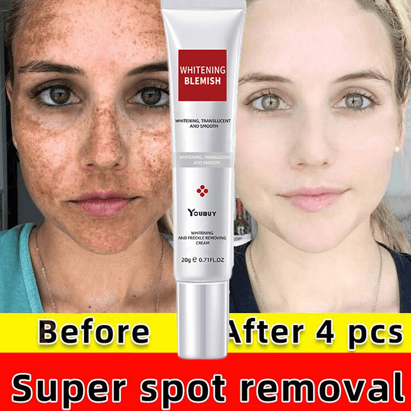 Best of Whitening Freckle Cream Effective Remove Melasma Serum Fade Dark Spots Melanin Moisturize Brighten Smooth Face Korean Skin Care Reviews & Tips