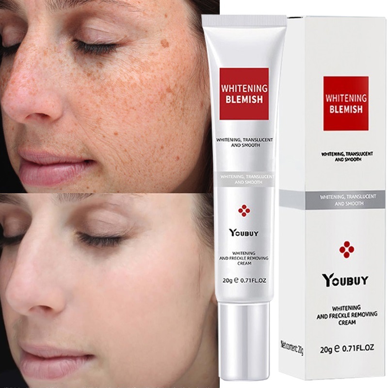 Best of Whitening Freckle Cream Effective Remove Melasma Cream Remove Dark Spots Melanin Moisturize Brighten Smooth Face Skin Care Reviews & Tips