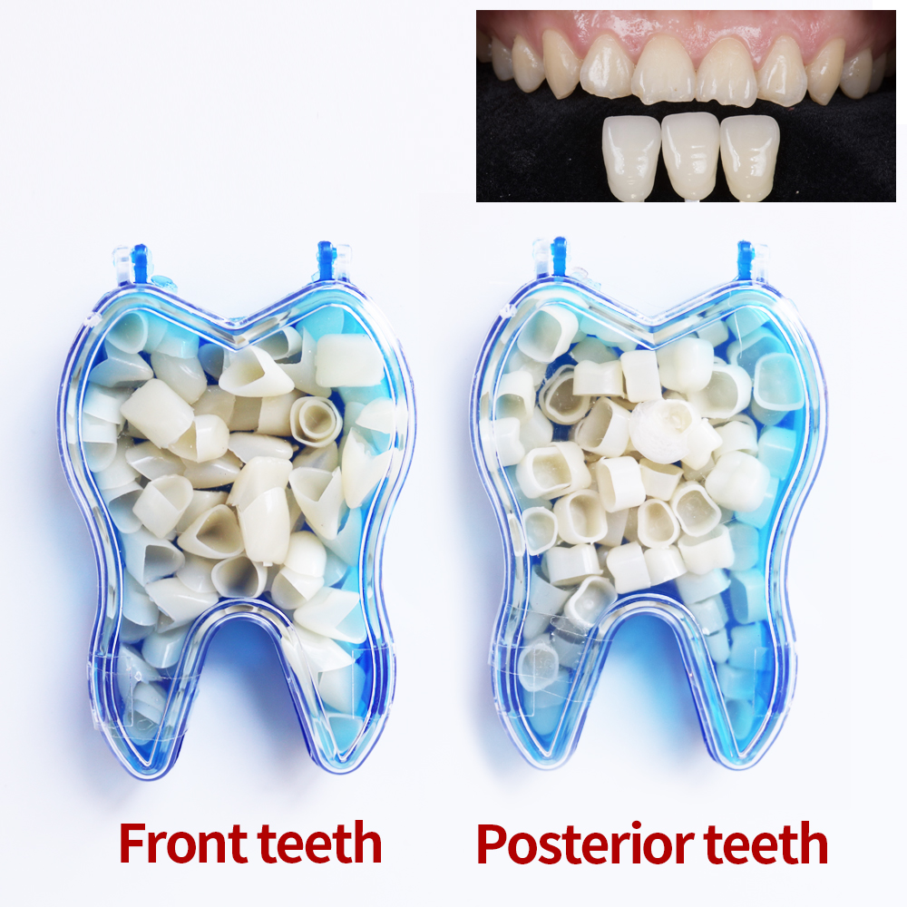 Best of 50 Pcs Dental Temporary Crown Veneers Material Anterior Front Molar Teeth Missing Teeth Repair Reviews & Tips