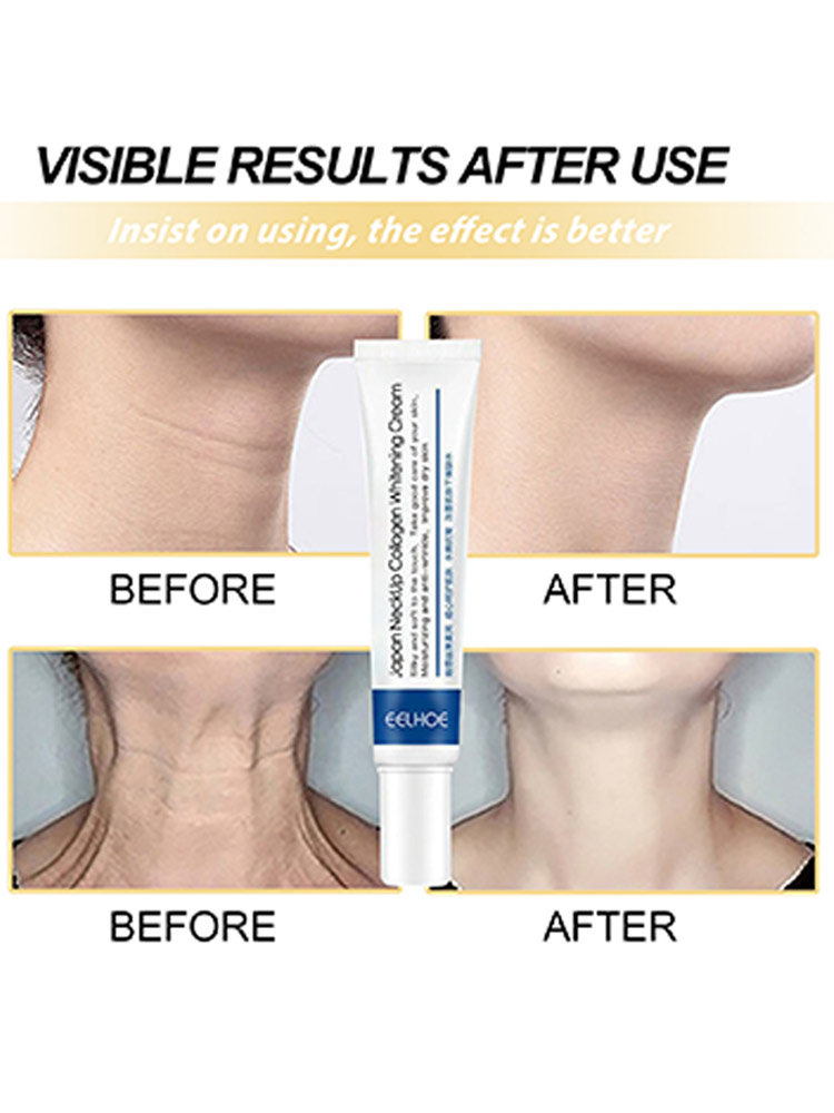 Best of Neck Lines Protein Cream Moisturis Nourish Lift Neck Eliminate Double Chin Eliminate Neck Fine Lines Anti-ageing Rejuvenation Reviews & Tips - Image 4