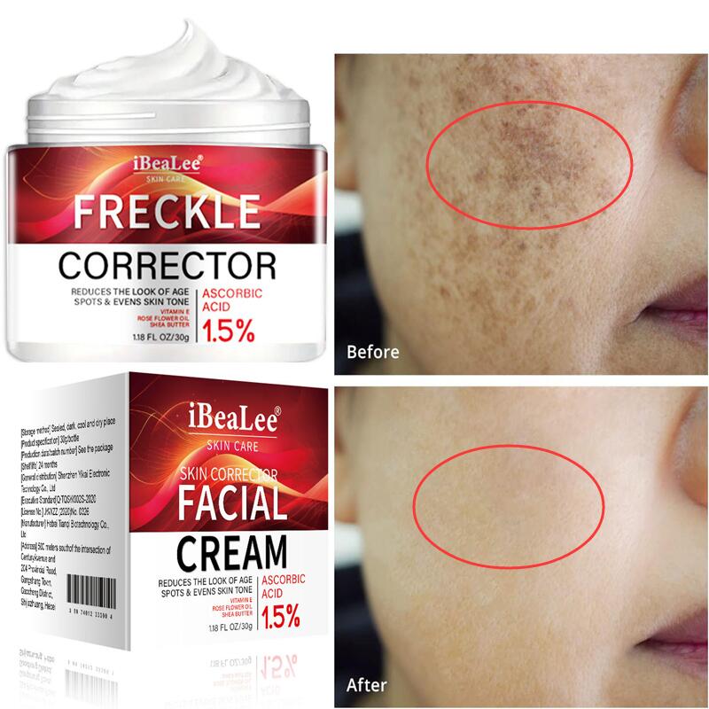 Best of Hot Powerful Whitening Cream Skin Care Remove Freckle Melasma Dark Spots Corrector Lighten Melanin Pigmentation Brighten Product Reviews & Tips