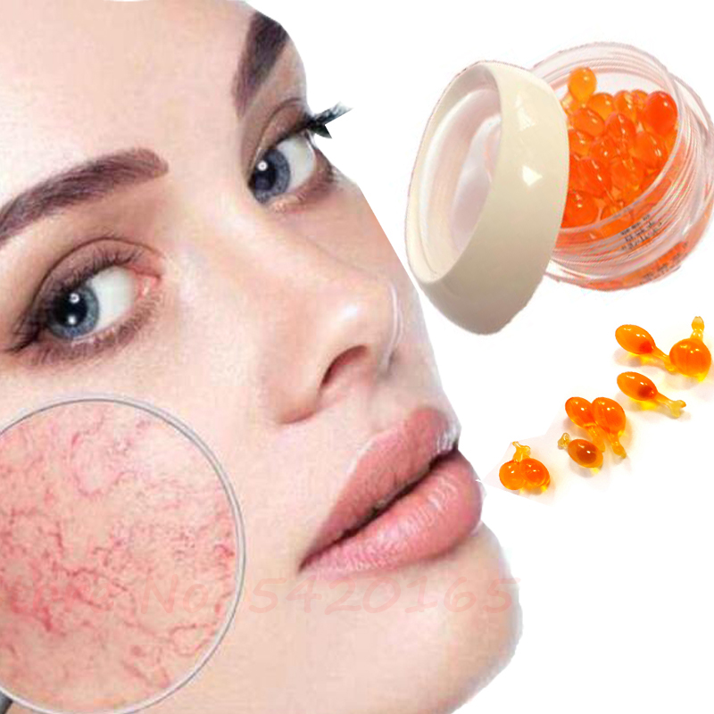 Best of Facial Varicose Vein Essence Anti Redness Spider Vein Remover Advanced Treatment Clearer Skin Veins Whitening And Moisturizing Reviews & Tips