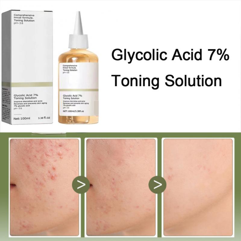 Best of Glycolic Acid 7% Toning Solution Dispelling Acne Acne Remover Lifting Firming Wrinkles Glowing Facial Skin Care Acid Toner New Reviews & Tips