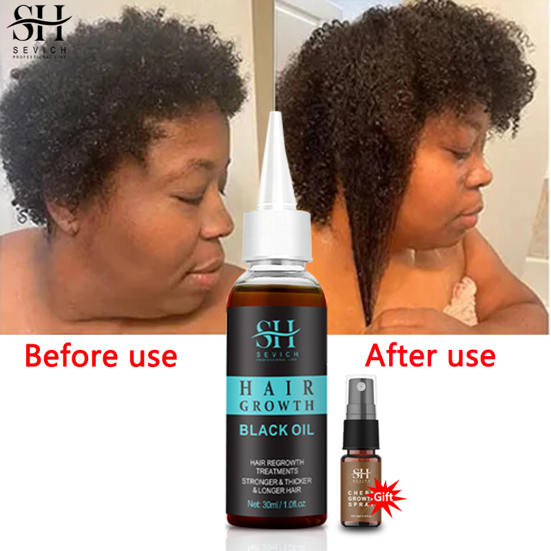 Best of Africa Fast Hair Growth Oil Traction Alopecia Hair Thinning Treatment Essence Black Oils Repairs Damage Anti-Hair Loss Products Reviews & Tips