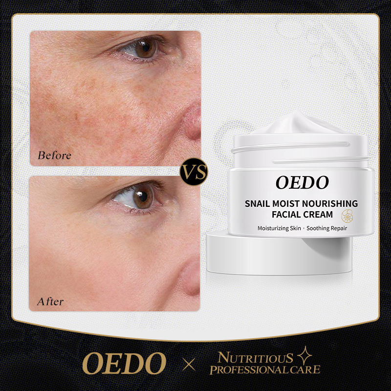 Best of OEDO Anti-aging Face Cream Snail Face Cream Anti-wrinkle Lightening Wrinkles Whitening Moisturizing Face Nourishing Skin Care Reviews & Tips