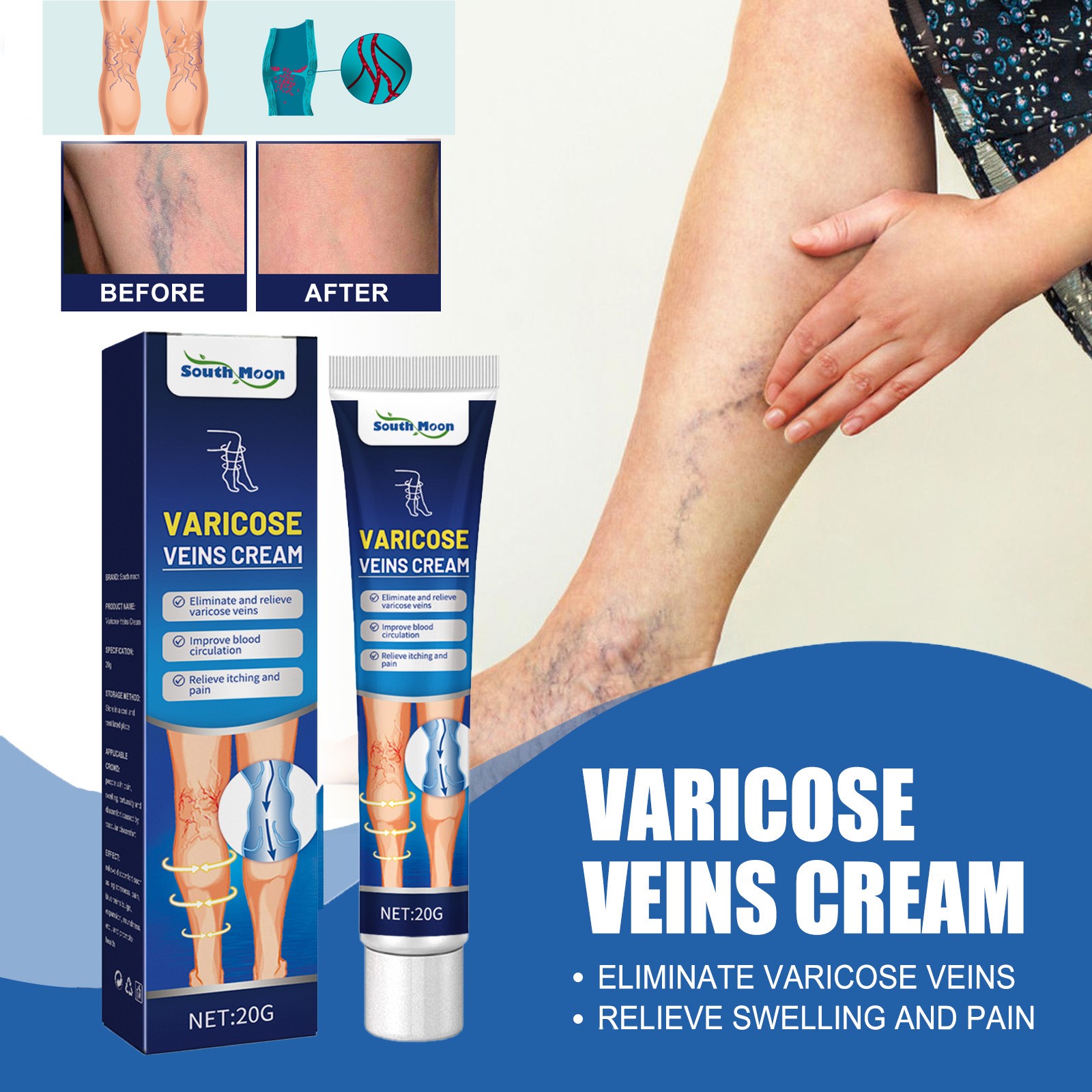 Best of 20g Venous Massage Varicose Cream Relieves Leg Vascular Protrusion, Varicose Veins, Earthworm Leg Repair Tool Reviews & Tips