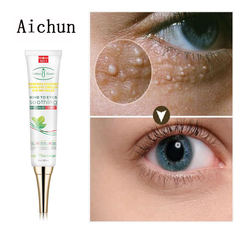 Best of Effective Remove Fat Granules Eyes Cream Fade Fine Lines Eye Bags Vitamin E Anti-Wrinkle Firming Anti Dark Circle Eye Skin Care Reviews & Tips