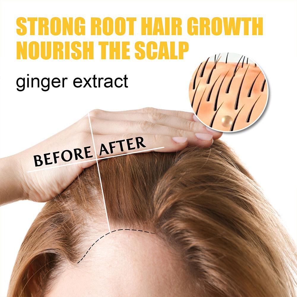 Best of Ginger Soap Anti Hair Loss Soap Repair Scalp Nourishing Brighten Thick Hair Care Prevent Hair Loss Shampoo Bar 65g Reviews & Tips - Image 3