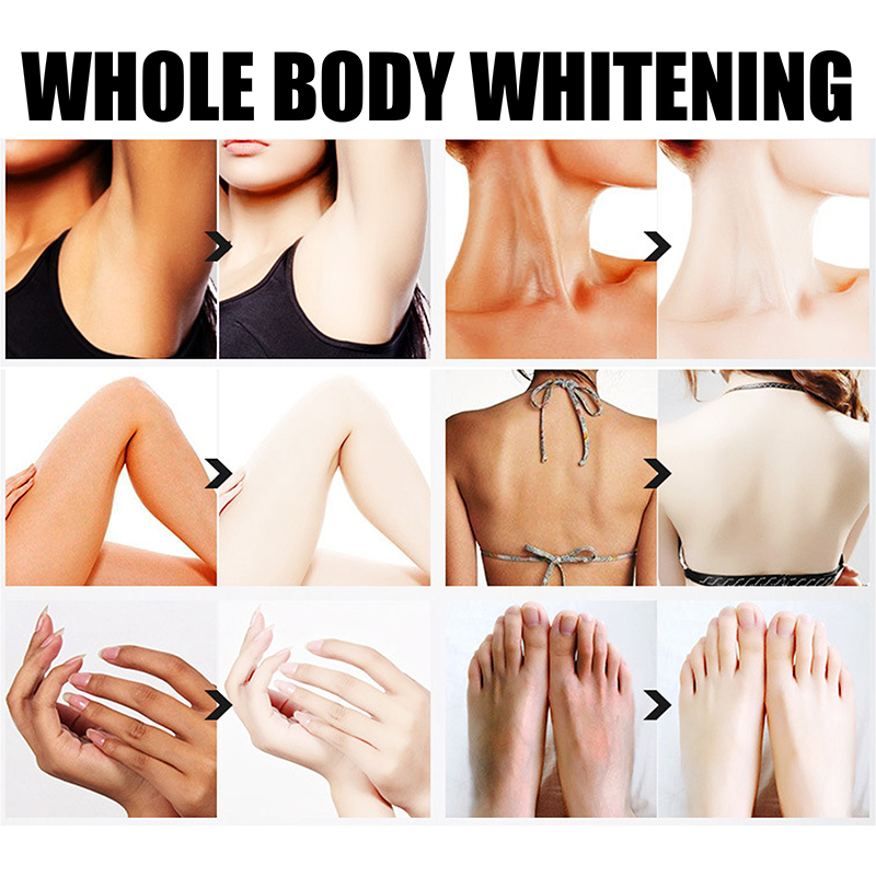 A collage of before-and-after images showcasing different body parts, including underarms, neck, back, hands, and feet, to illustrate the effects of Skin Lightening Cream on dark spots.