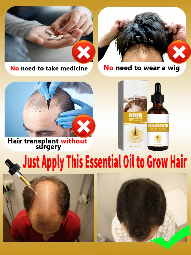 Best of Effective Hair Growth Oil For Men Women Biotin Fast Treatment Baldness Repair Hereditary Postpartum Serum Reviews & Tips - Image 2