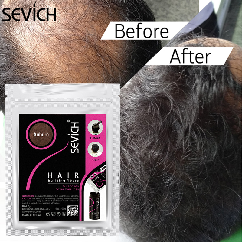 Best of Sevich 50g Instant Hair Growth Fiber Refill 10 Colors Keratin Hair Building Fiber Spray Fiber Hold Spray Powder Hair Treatment Reviews & Tips - Image 4