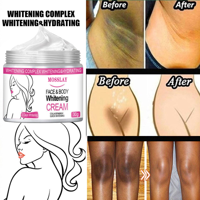 Best of Whitening Cream Face Body Moisturizer Illuminate Dark Skin Neck Under Arms Armpit Bikini Private Part Knees Elbow Between Legs Reviews & Tips