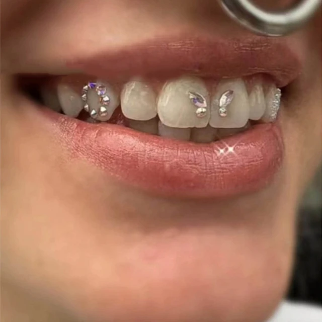 Tooth Gem Kit Reflective Teeth Dental Gems DIY Kit Artificial Crystal  Diamond Teeth Ornaments Decorative Jewelry With Glue And - AliExpress