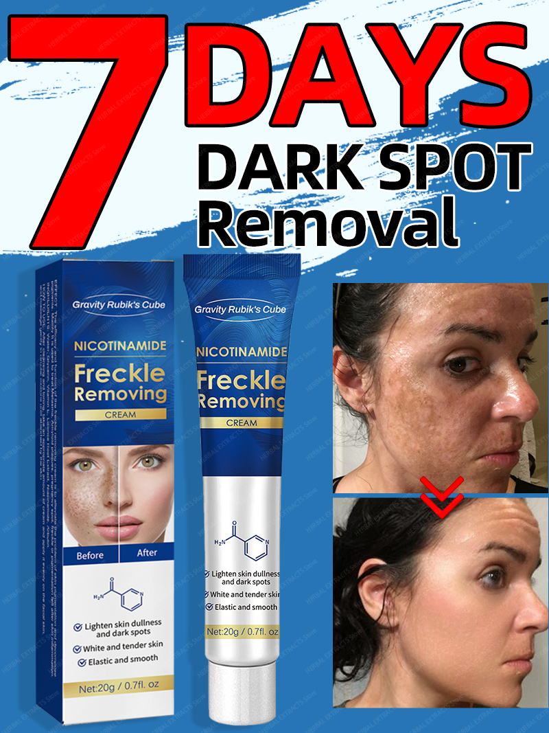 Best of Dark Spot Remover For Face Removal Cream Age Sun Black Spots Freckles Melasma Reviews & Tips