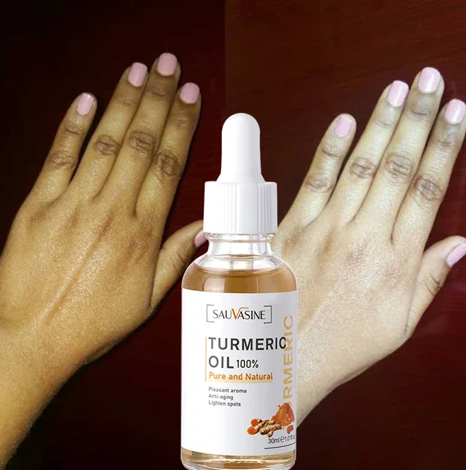 Best of Turmeric Oil Face Whitening Serum Lightening Acne Dark Patches Anti-aging Bright Skin Acne Dark Spot Corrector Skin Care Reviews & Tips