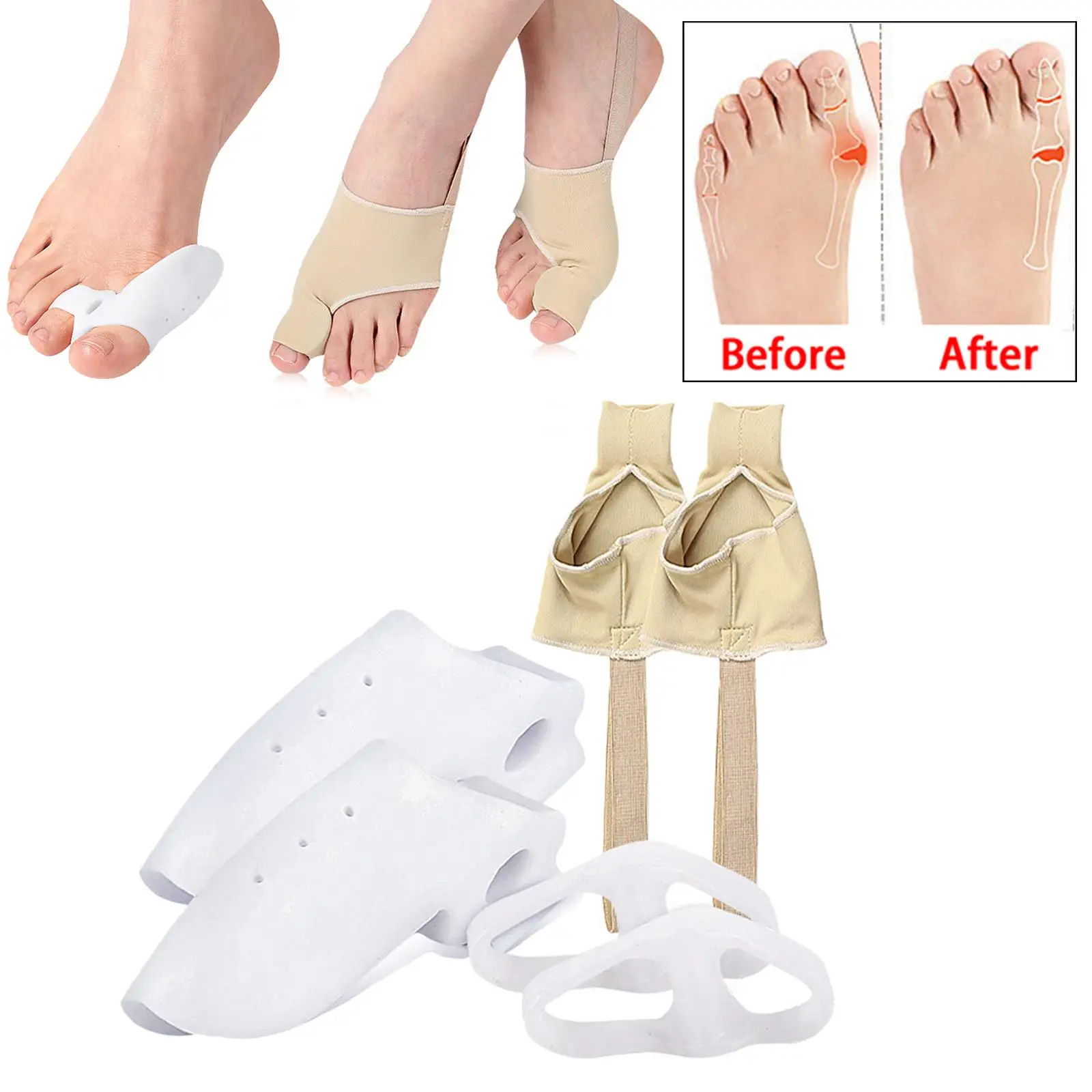 Bunion Corrector Kit Toe Splitter Toe Spreader Toe Stretcher Day/Night Support Hallux Valgus Relief Bunion Pads Sleeves Brace