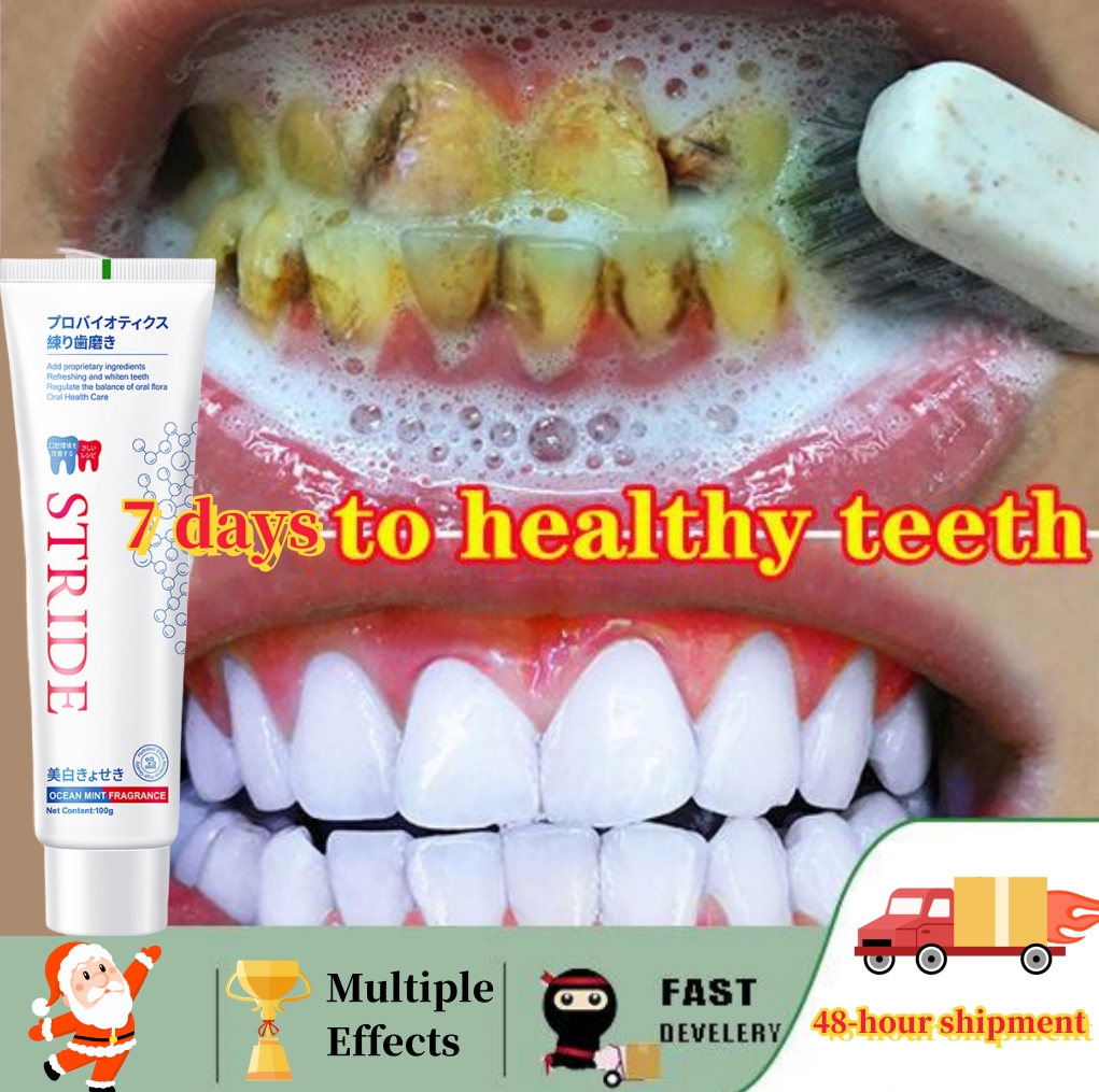 Best of Dental Calculus Remover Whitening Teeth Toothpaste Mouth Odour Removal Bad Breath Prevent Periodontitis Caries Repair Tooth Care Reviews & Tips