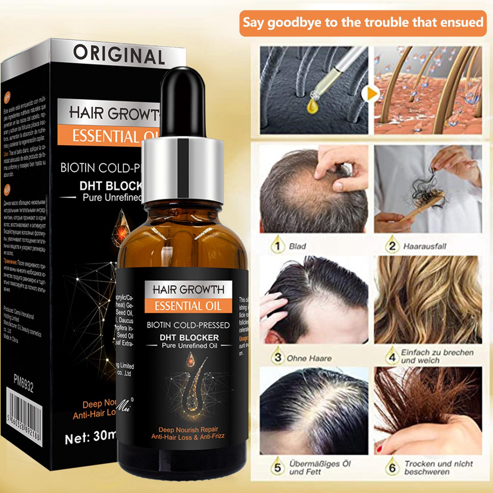 Best of Hair Growth Essential Oil Biotin Cold-Pressed DHT Blocker And Hair Growth Shampoo Anti-Hair Loss Conditioner Hair Accessories Reviews & Tips