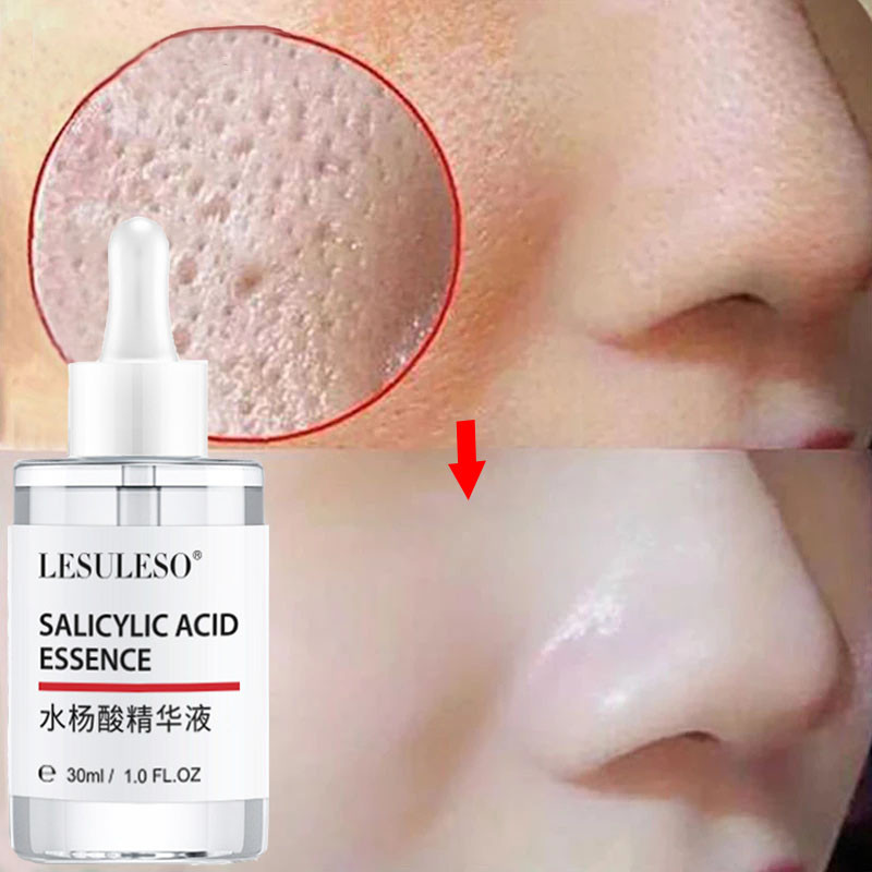 Best of Lactobionic Acid Pore Shrink Serum Face Large Pores Remover Purify Open Pores Smooth Tender Skin Moisturize Care Korean Cosmetic Reviews & Tips