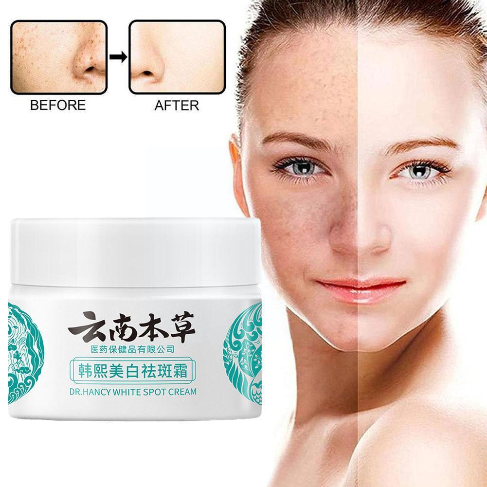 Best of 20g Yunnan Herb Powerful Whitening Freckle Cream Remove Skin Acne Spots Care Spots Beauty Dark Moisturizing Face Fa X1U6 Reviews & Tips