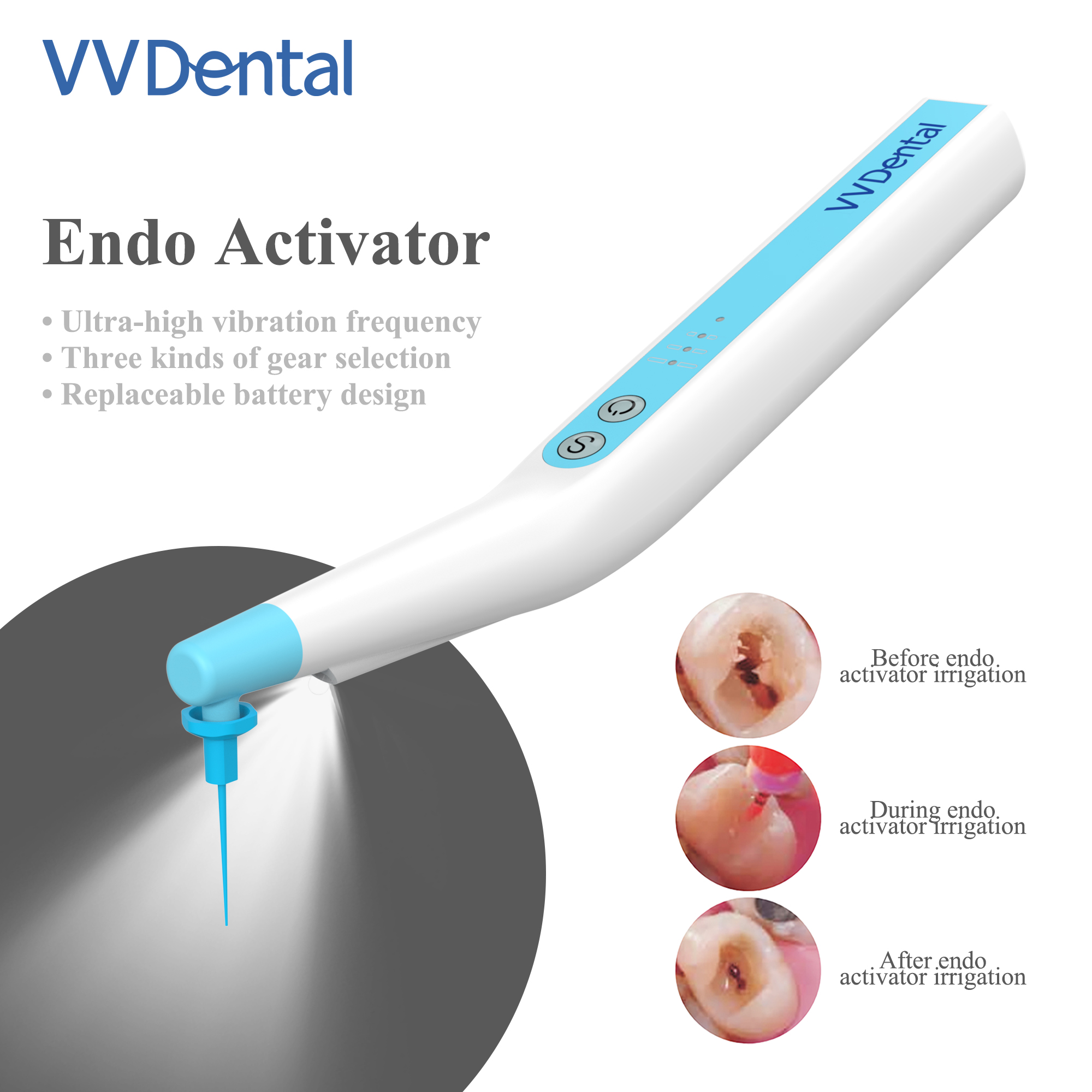 Best of Endo Activator Dental Root Canal Sonic Irrigator LED With 60Pcs Tips Endomotor File For Endodontic Cleaning Irrigating Dentistry Reviews & Tips