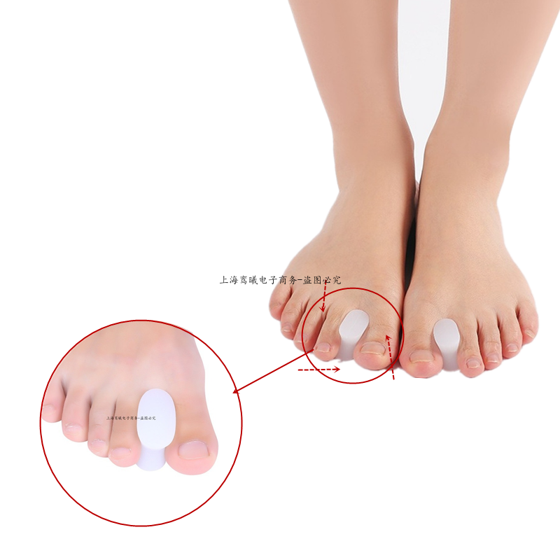 2 stücke = 1 paar Gel Toe Separator Fußpflege Spacer Silikon Haarglätter Finger Valgus Hallux Bunion Protector Orthopädische korrektor – Detail 2