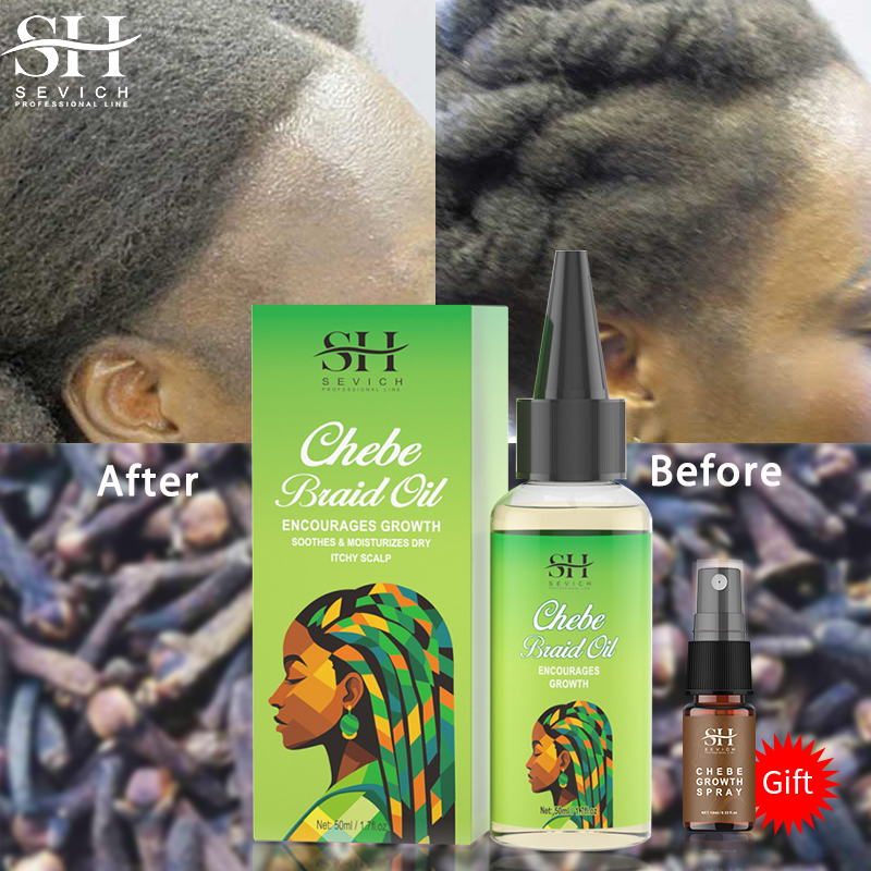 Best of Fast Hair Growth Oil African Crazy Traction Alopecia Chebe Anti Scalp Itching Anti Hair Break Hair Strengthener Hair Loss Spray Reviews & Tips