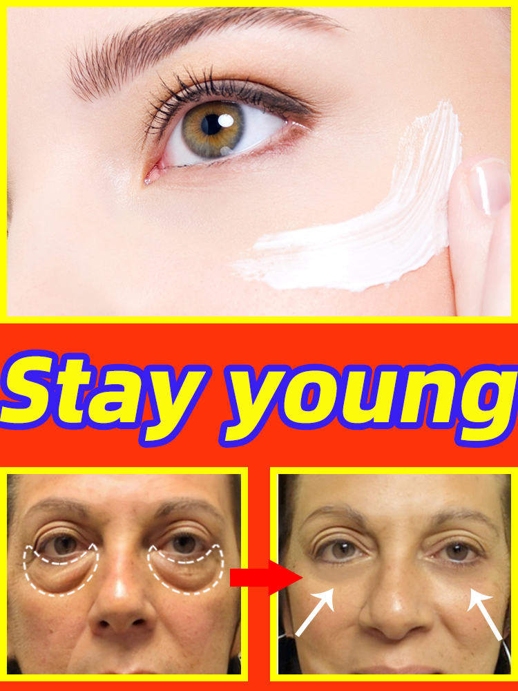 Best of Anti-Wrinkle Eye Cream Dark Circles Remove Eye Bags Puffy Eyes Reduce Crow's Feet Wrinkles Fine Lines Eye Fat Particles Eye Care Reviews & Tips