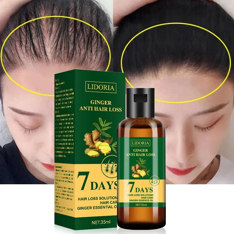 Best of Ginger Hair Growth Serum 7 Days Anti Hair Loss Treatment Fast Ginger Hair Promoting Regenerate Nourish Hair Beauty Care Products Reviews & Tips