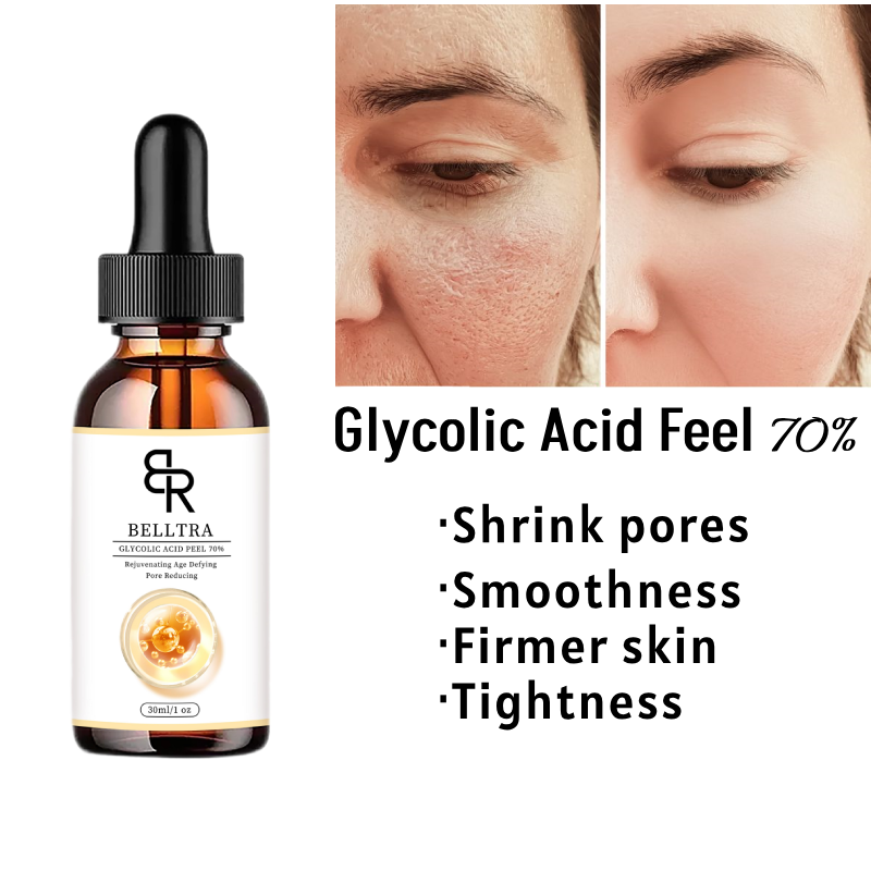 Best of Glycolic Acid Chemical Peel 70% Peeling Acid Smoothes Fine Lines Skin Pigmentation Acne Scar Skin Brighten 30ml Reviews & Tips