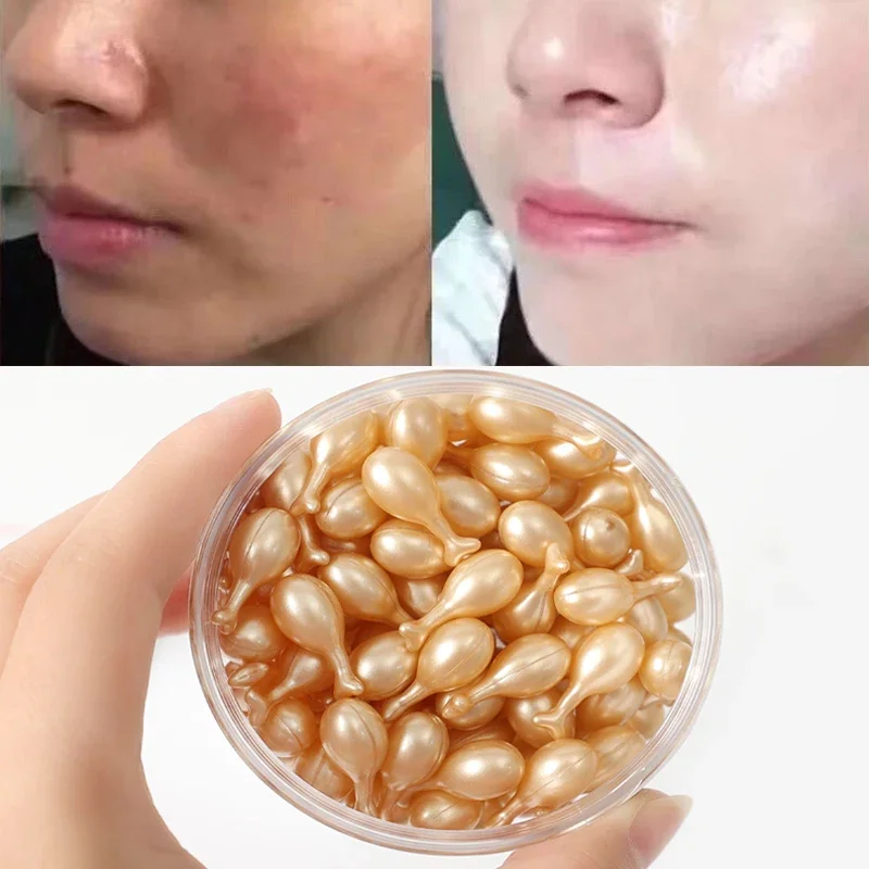 Best of 100pcs Fullerene Whitening Serum Spot Remover Anti-Wrinkle Firming Brighten Skin Tone Highly Hydrating Skin Care Face Makeup Reviews & Tips