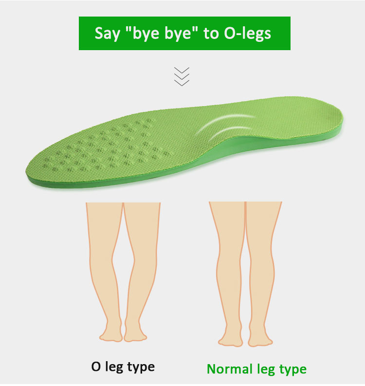 O/X-Leg Orthopädische Einlegesohlen zur Unterstützung des Fußgewölbes, orthopädische Einlegesohle, Valgus Varus-Schuhpolster, Massagepolster für Schuheinlagen, Sohle, Fußpflege – Detail 4