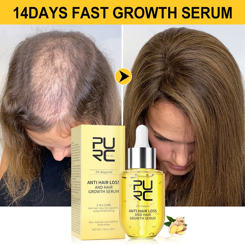 Best of PURC Ginger Hair Growth For Men Women Anti Hair Loss Oil Treatment Fast Regrowth Thicken Serum Hair Care Beauty Health Products Reviews & Tips