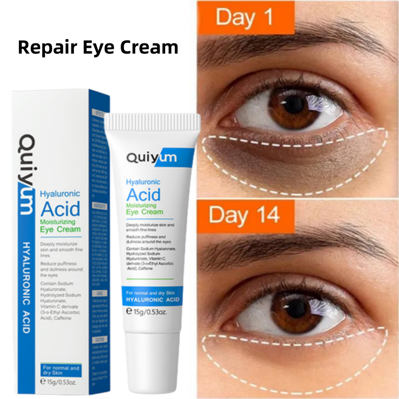 Best of New Eye Dark Circles Remover Cream Repair Skin Barrier Fade Eyes Bag Puffiness Fine Lines Anti-aging Wrinkles Lift Firm Eye Care Reviews & Tips