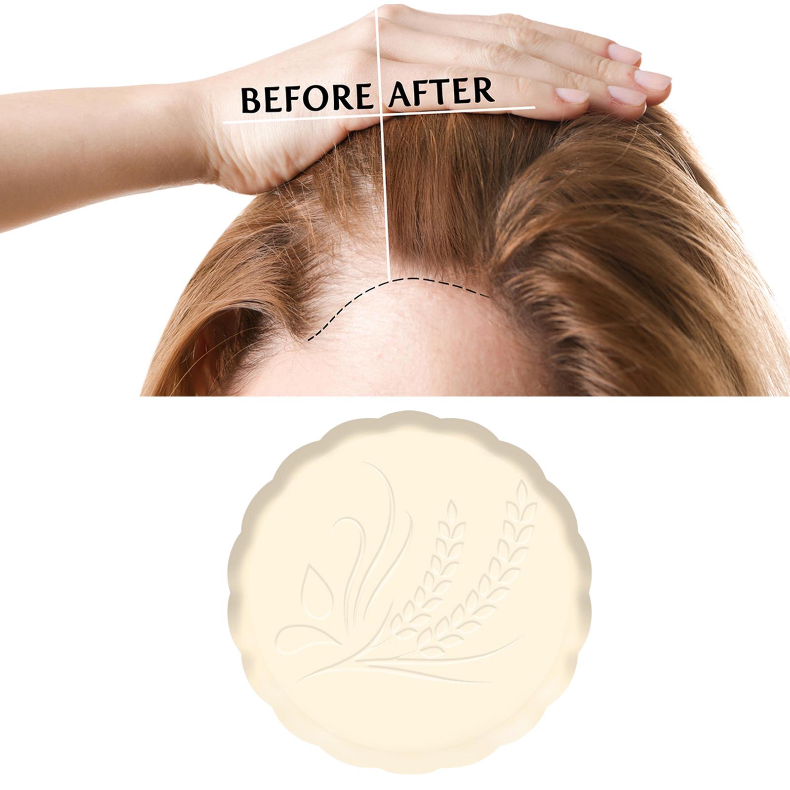 Rice Shampoo Bar Moisturizing Eco Friendly Solid Shampoo Soap for Hair Growth Promotes Healthy Hair Growth Dry Damaged Hair Girl