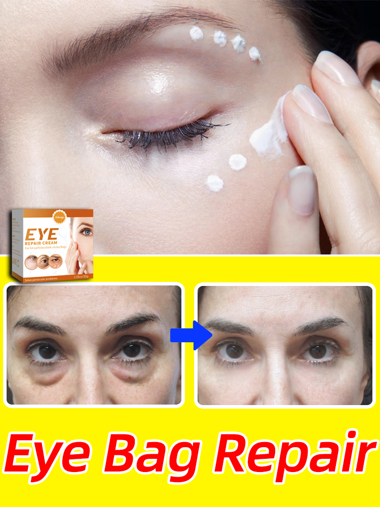 Best of Eye Cream Bags Anti Dark Circle Puffy Eyes Care Reviews & Tips