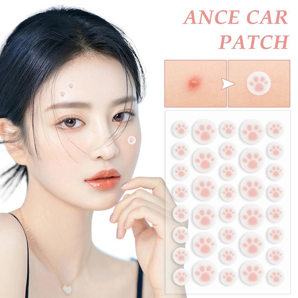 Best of Cat Claws Acne Removal Pimple Patch Removal Skin Care Stickers Originality Concealer Face Spot Beauty Makeup Tool Ance Care Reviews & Tips