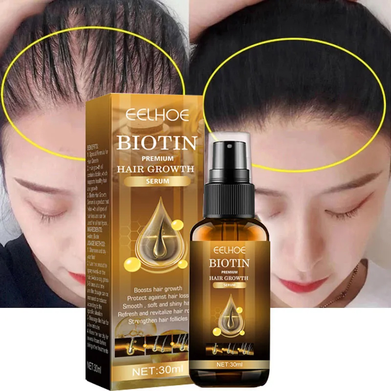 Best of Biotin Fast Hair Growth Products Anti Hair Loss Serum Spray Prevent Baldness Treatment Scalp Beard Beauty Hair Care Men Women Reviews & Tips