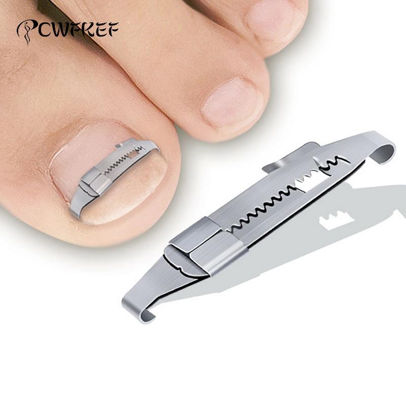 Best of Ingrown Toenail Corrector Tools Pedicure Recover Embed Toe Nail Treatment Professional Ingrown Toenail Correction Foot Care Tool Reviews & Tips