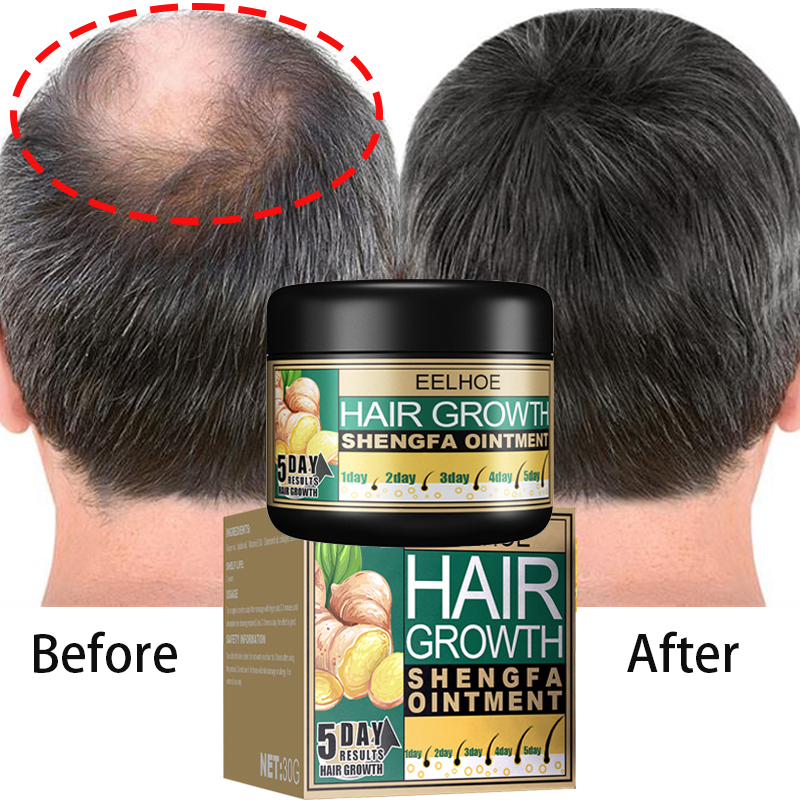 Best of Hair Growth Products Ginger Regrowth Repair Cream Prevent Hair Loss Baldness Treatment Dense Hair Beauty Hair Care Men Women Reviews & Tips