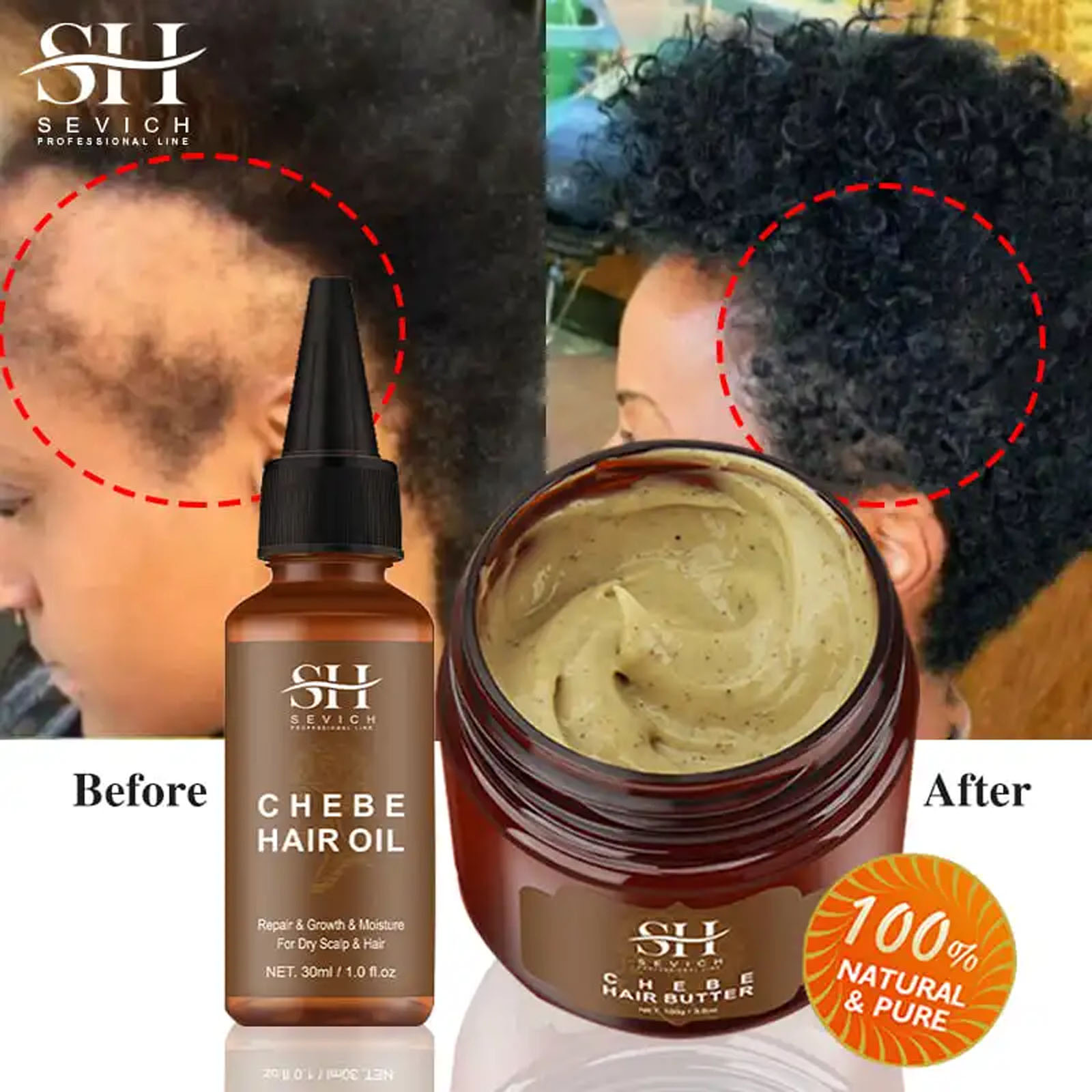 Best of Chebe Fast Hair Growth Product African Crazy Traction Alopecia Hair Oil Anti Hair Break Hair Strengthen Hair Loss Treatment Care Reviews & Tips