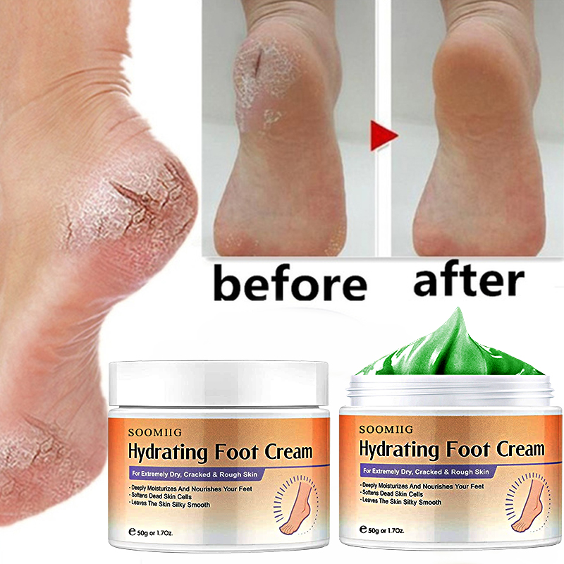 Best of Cracked Heel Balm Cream For Rough Dry Cracked Chapped Hand / Feet Heel Skin Care Cream Natural Essence Skin Care For Body Reviews & Tips