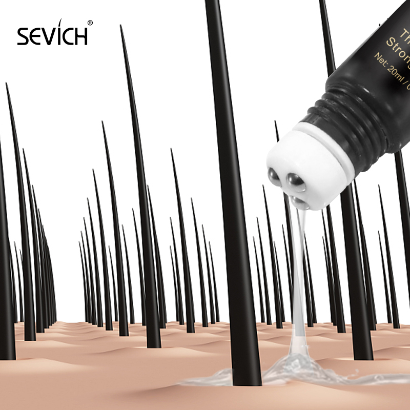 Best of Sevich Hair Growth Oil Ginger Extract Growing Serum Prevent Hair Loss Care Scalp Massage Roller Treatment Thickener Essence 20ml Reviews & Tips - Image 4