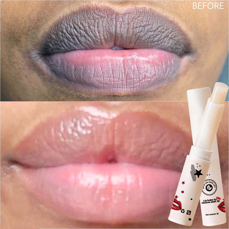 Best of Lip Balm Black Removal Moisturizing Lip Balm Repair Lip Brighten Instant Volumising Lip Plumper Serum Sexy Long Lasting Lip Care Reviews & Tips